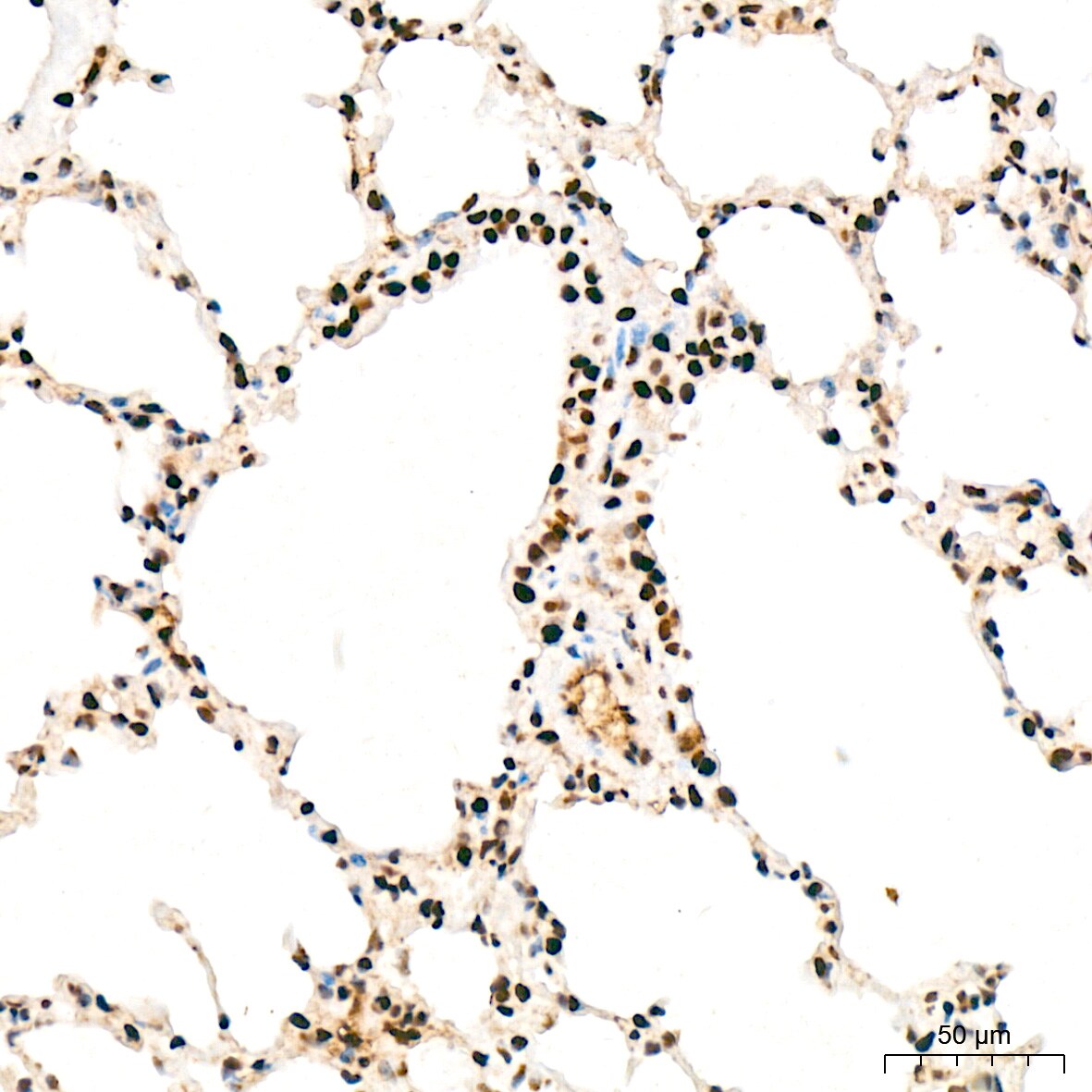 ANP32B Antibody (4A8E5)