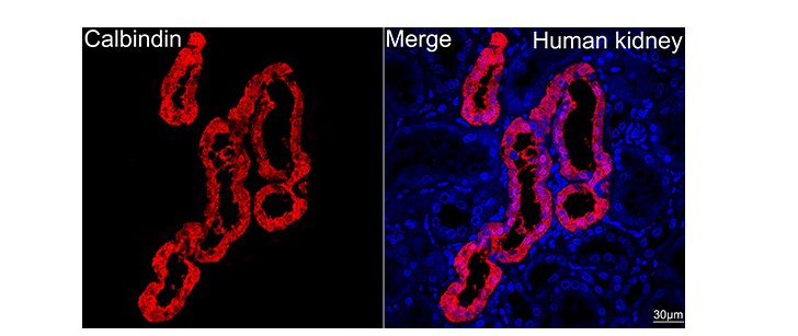 Calbindin D-28K Antibody (1K2K2)