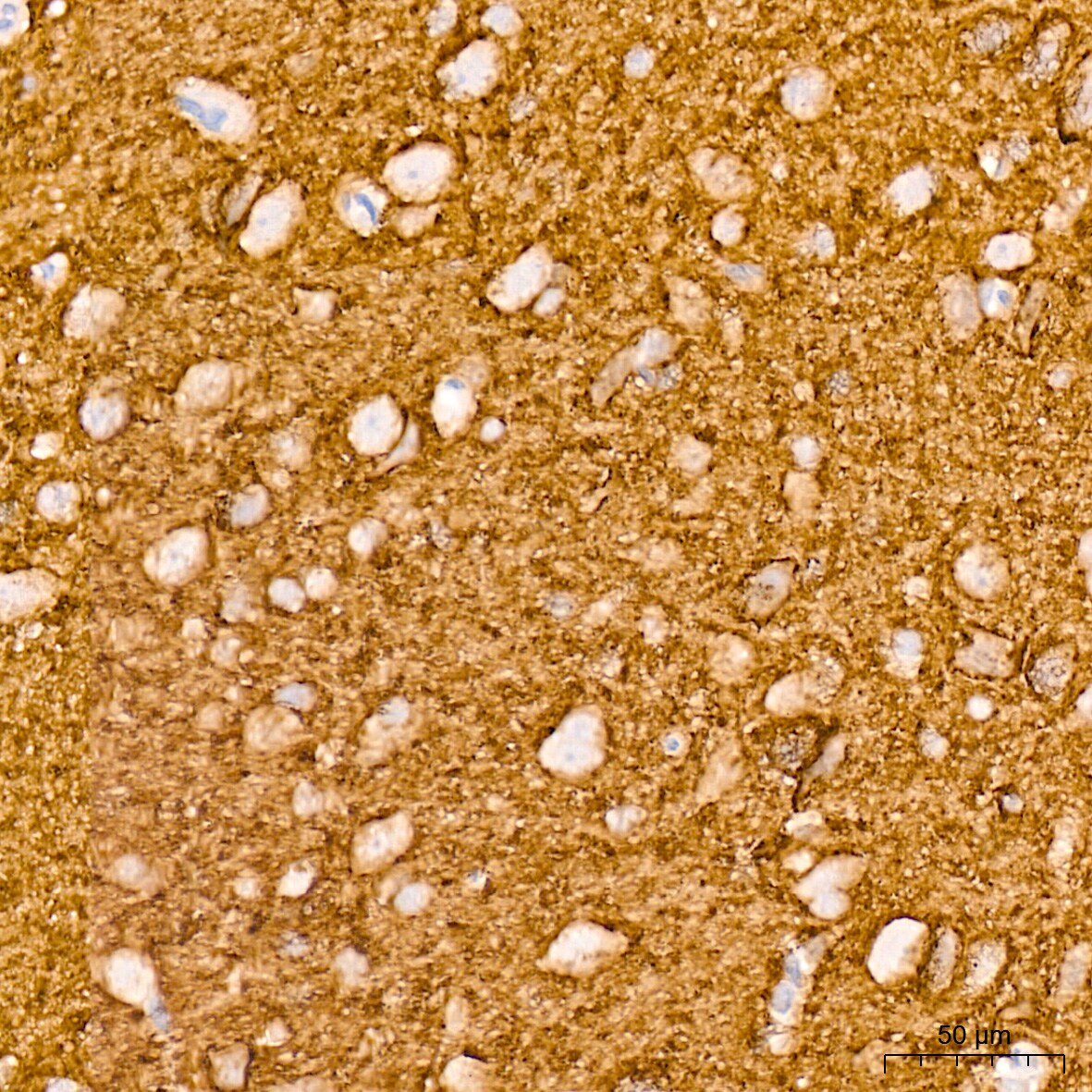 VAMP-1 Antibody (1A3K6)