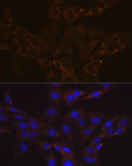 VAMP-1 Antibody (1A3K6)
