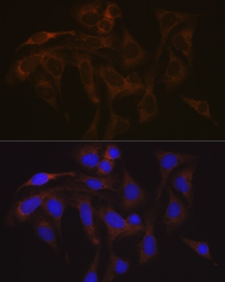 VAMP-1 Antibody (1A3K6)