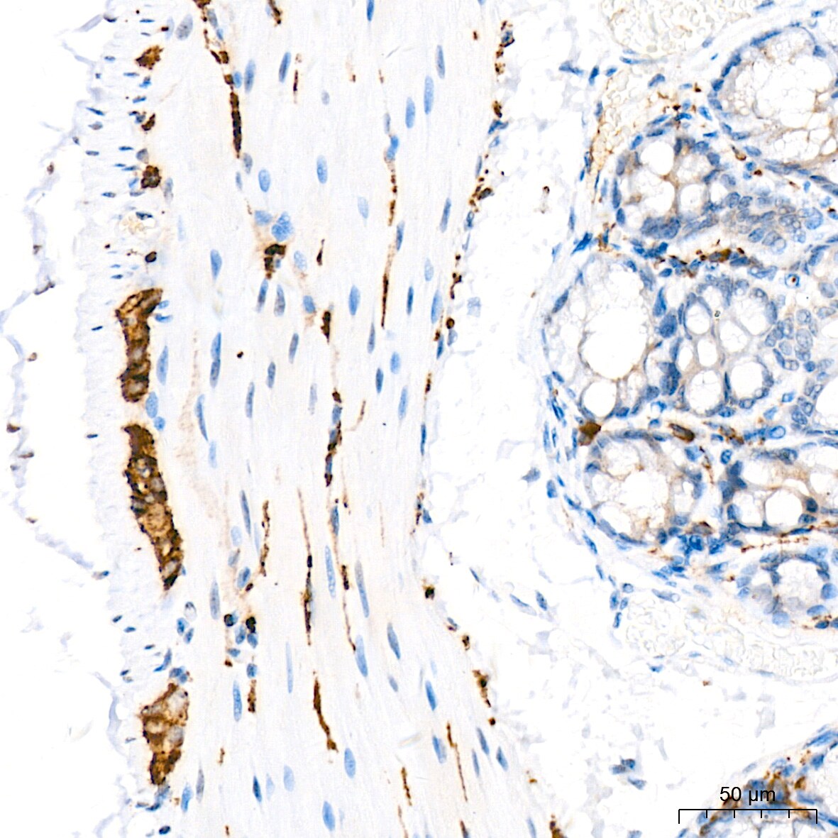 VAMP-1 Antibody (1A3K6)