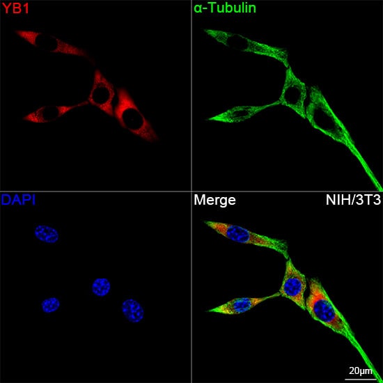 YB1 Antibody (9J7M4)