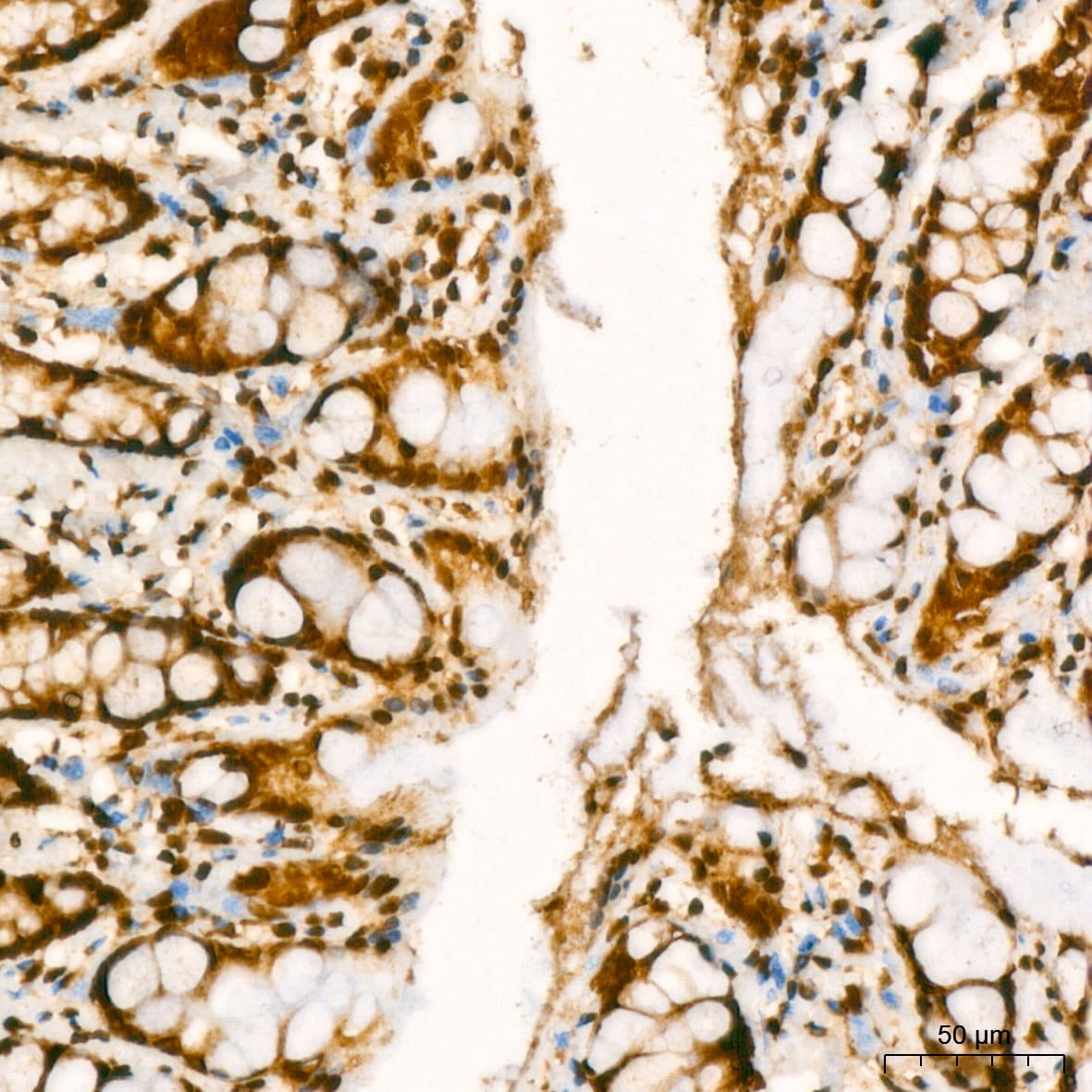 YB1 Antibody (9J7M4)