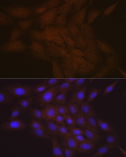 SMC4 Antibody (9Z8S3)