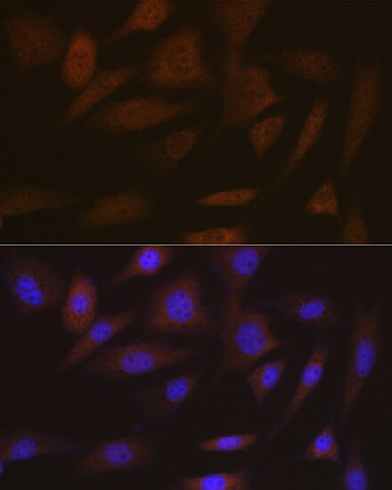 SMC4 Antibody (9Z8S3)