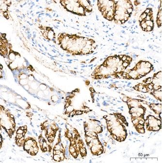 COX-2 Antibody (2V7G8) - BSA Free