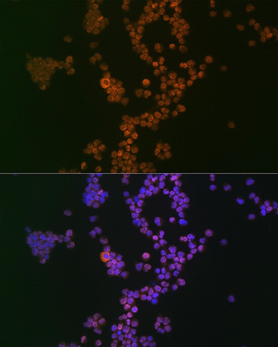 Ikaros/IKZF1 Antibody (4S10I3)