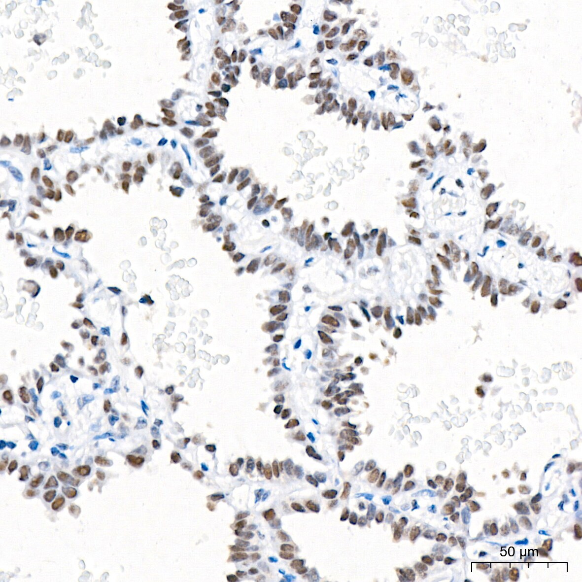 RCOR1/CoREST Antibody (9B3R7)