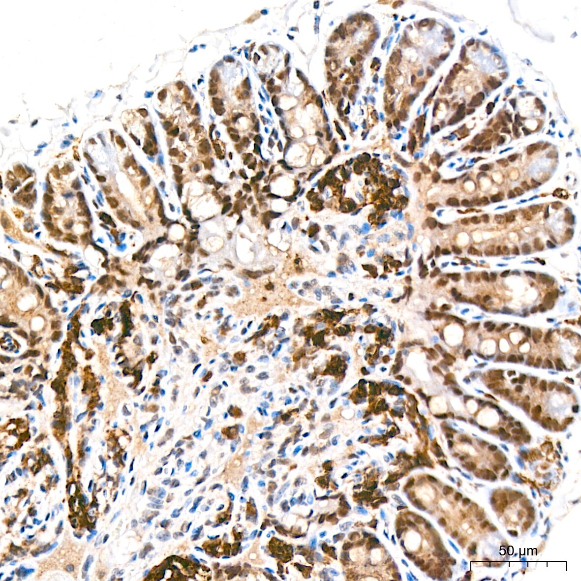 RCOR1/CoREST Antibody (9B3R7)