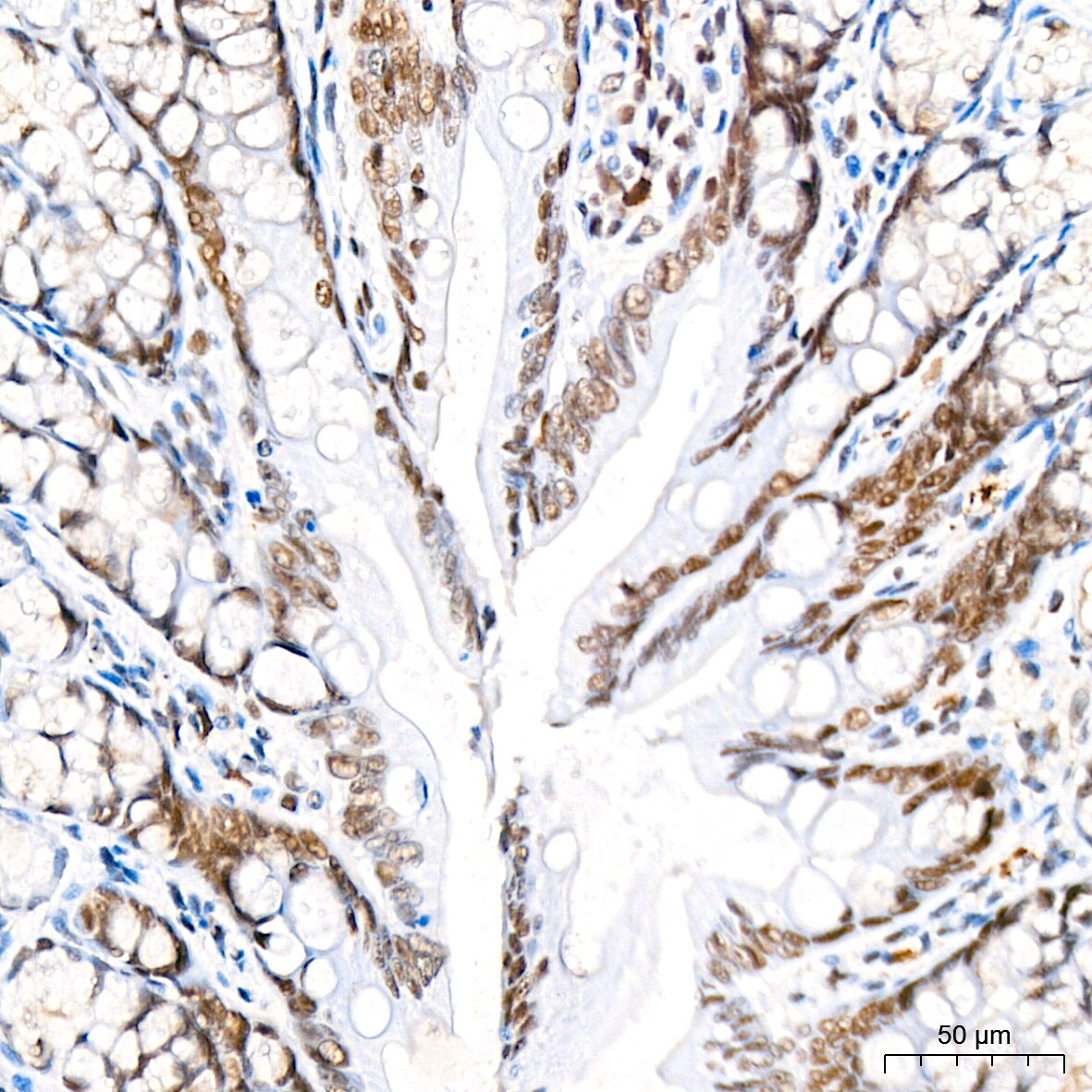 RCOR1/CoREST Antibody (9B3R7)
