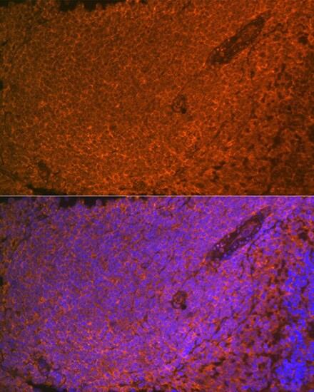SHIP Antibody (2F8U0)
