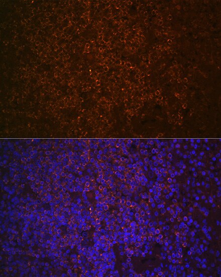 SHIP Antibody (2F8U0)