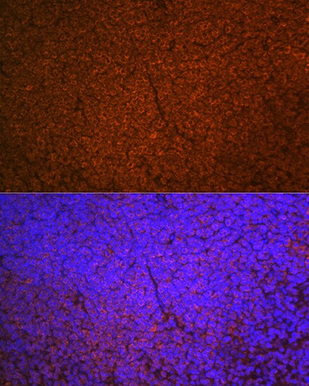 SHIP Antibody (2F8U0)