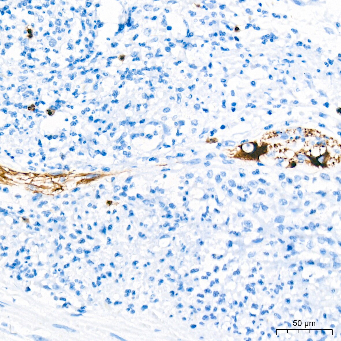 alpha-Internexin Antibody (5E5Z3)