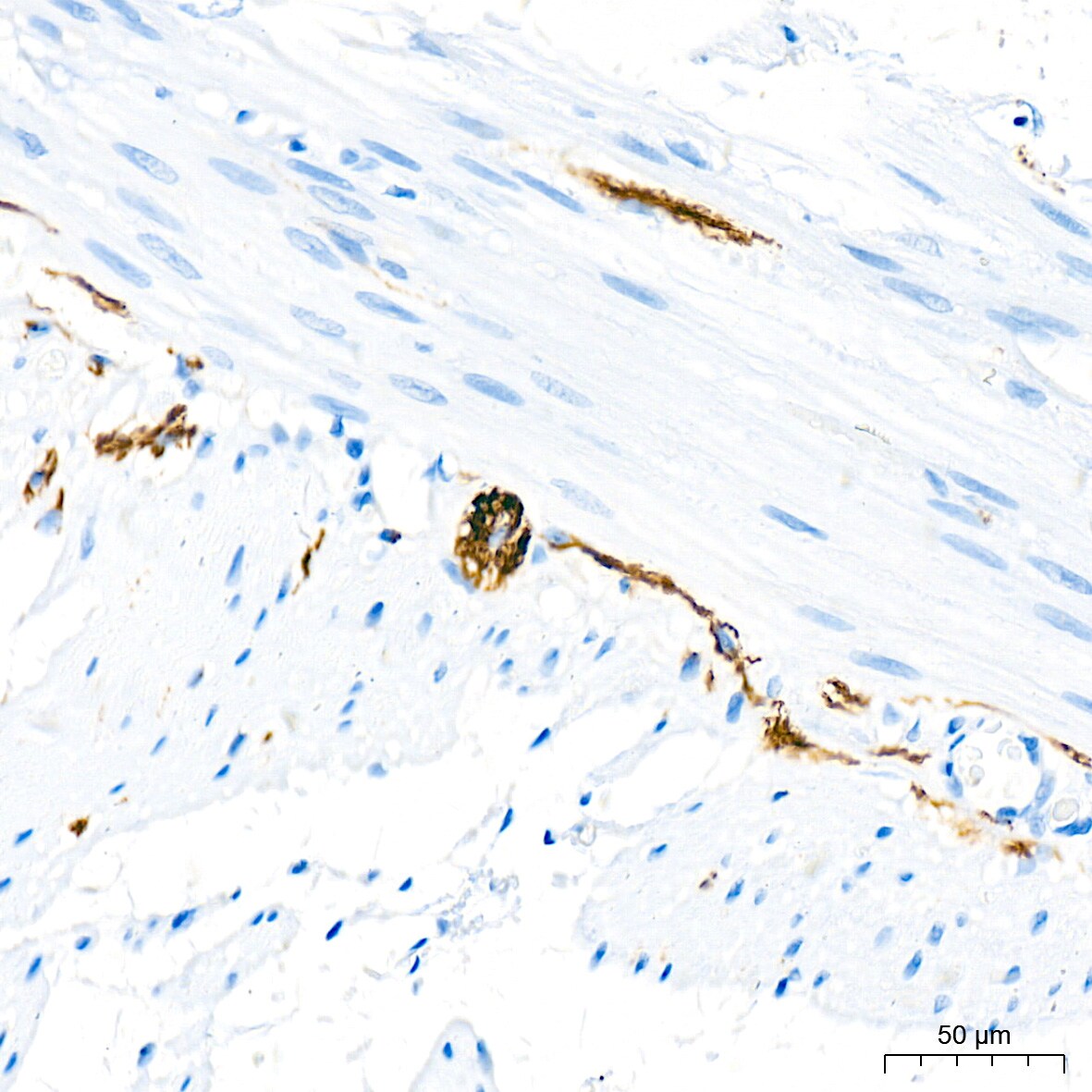 alpha-Internexin Antibody (5E5Z3)
