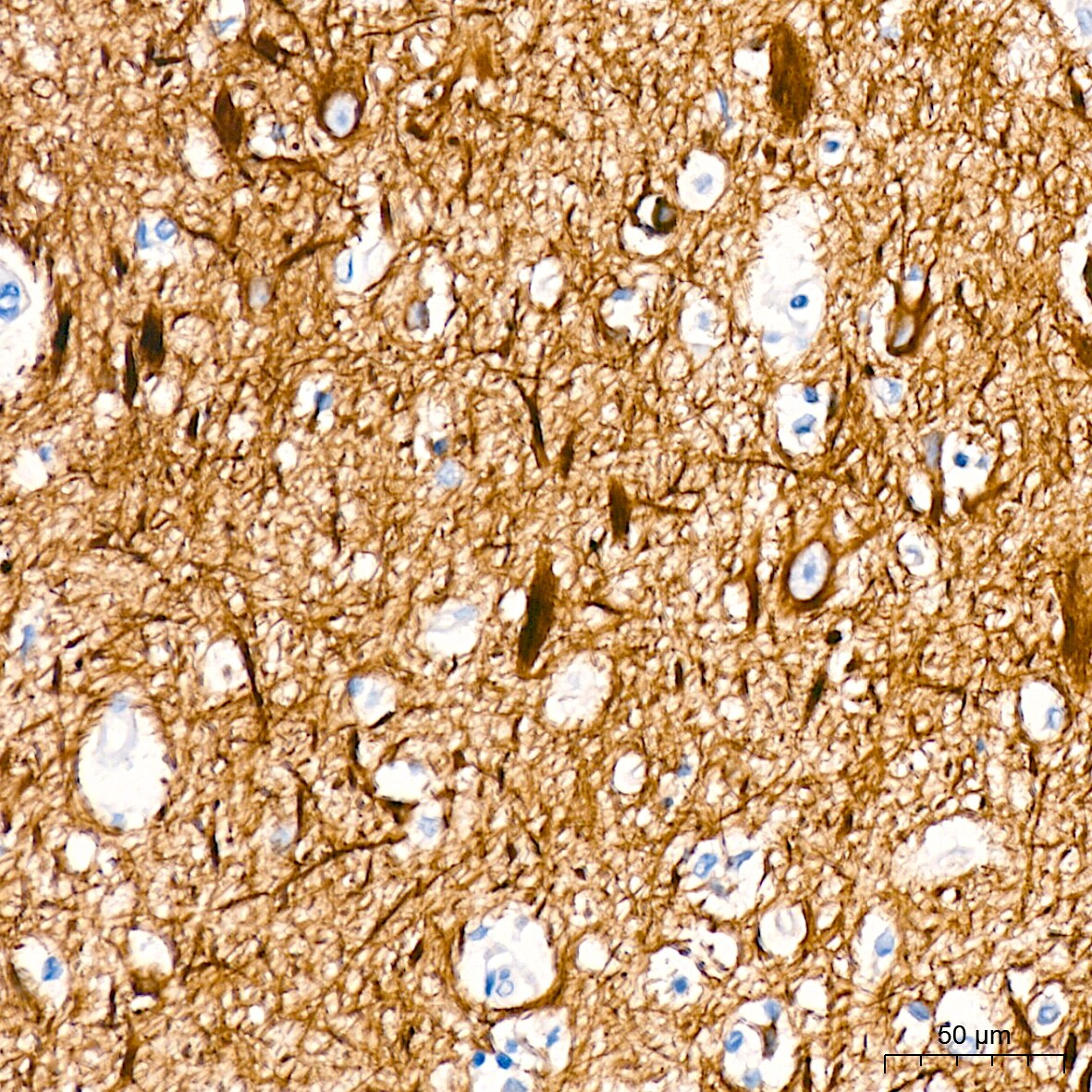 alpha-Internexin Antibody (5E5Z3)