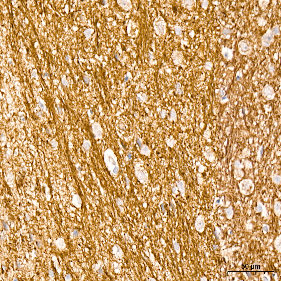 alpha-Internexin Antibody (5E5Z3)