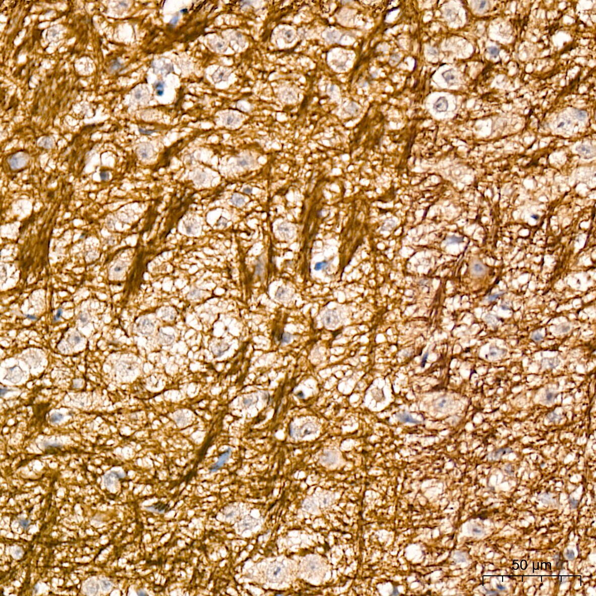 alpha-Internexin Antibody (5E5Z3)