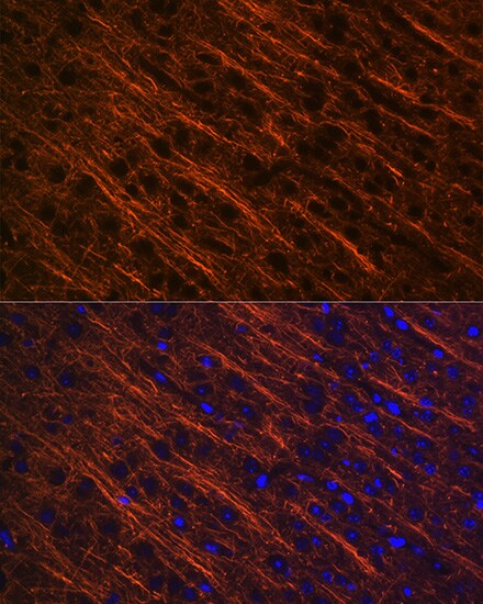 alpha-Internexin Antibody (5E5Z3)