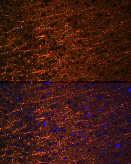 alpha-Internexin Antibody (5E5Z3)