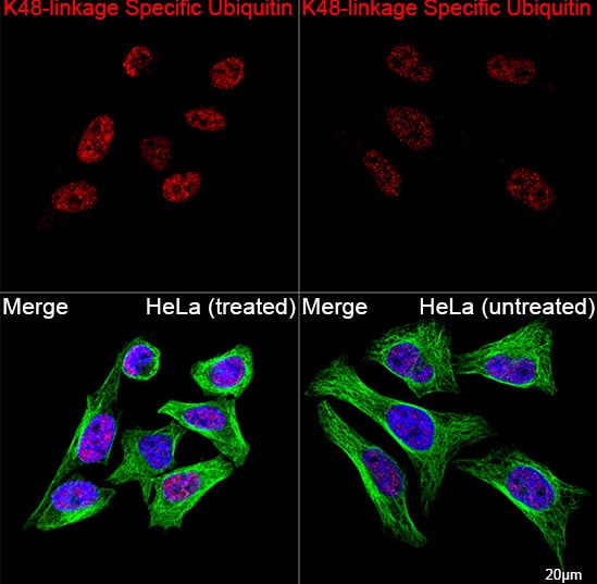 Poly-Ubiquitin Antibody (5Y8J0) - K48 Linkage