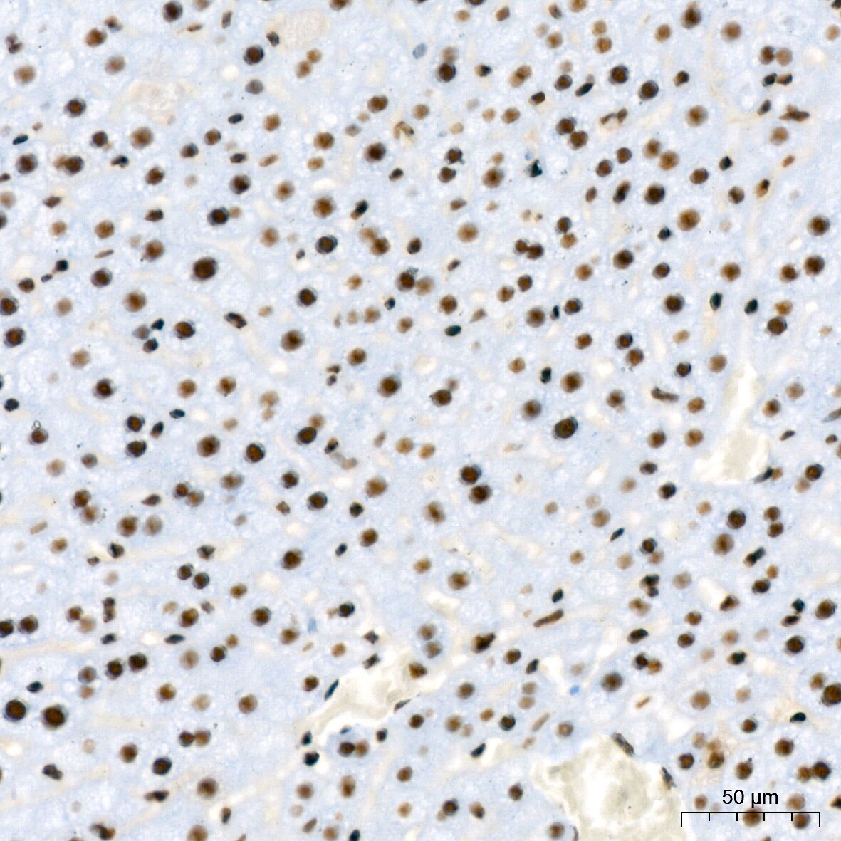 RBBP4/RbAp48 Antibody (0D1X1)