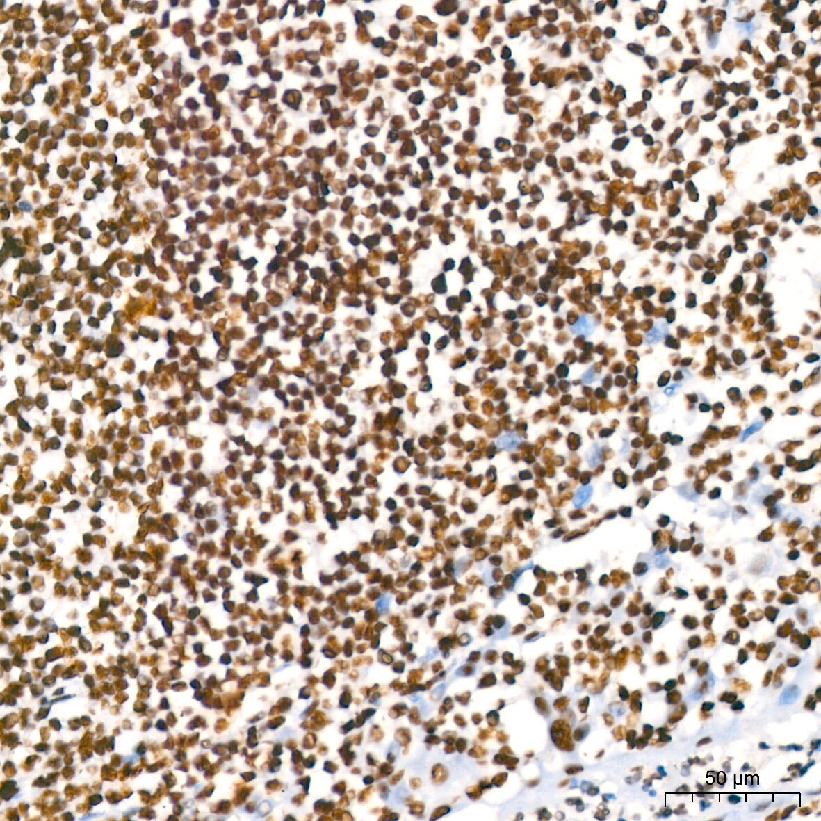 RBBP4/RbAp48 Antibody (0D1X1)