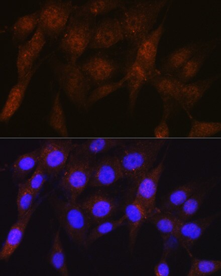 S5a/Angiocidin Antibody (5G1X6)