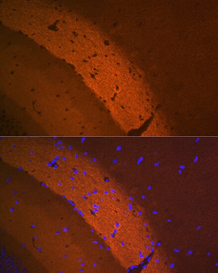 mGluR2 Antibody (0U6B5)