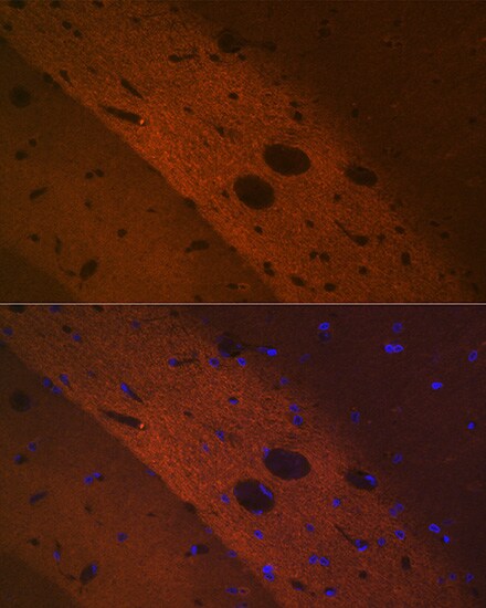mGluR2 Antibody (0U6B5)