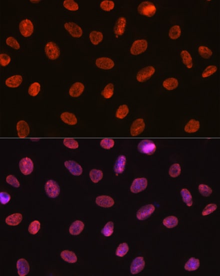 U1A Antibody (8I3P5)