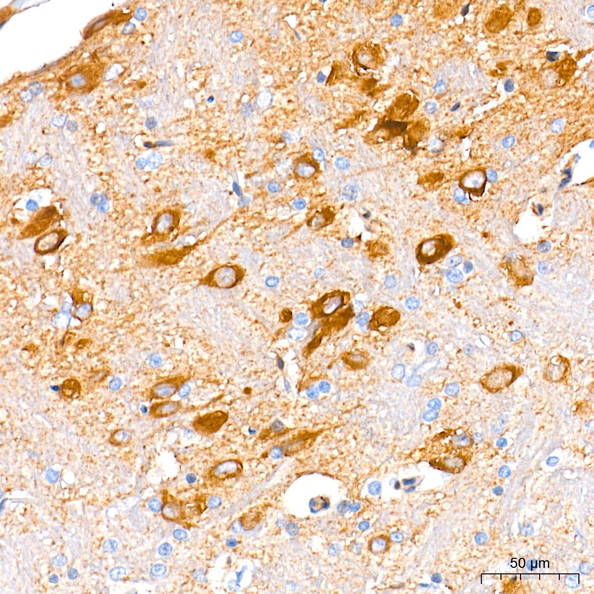 Guanylyl Cyclase beta 1 Antibody (5O8D9)