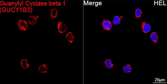 Guanylyl Cyclase beta 1 Antibody (5O8D9)