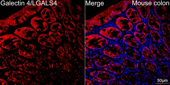 Galectin-4 Antibody (9Z2B5)