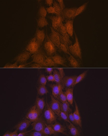 LIS1 Antibody (9O6X3)