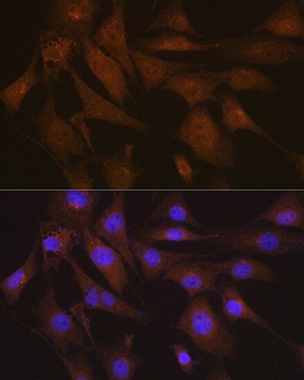 LIS1 Antibody (9O6X3)
