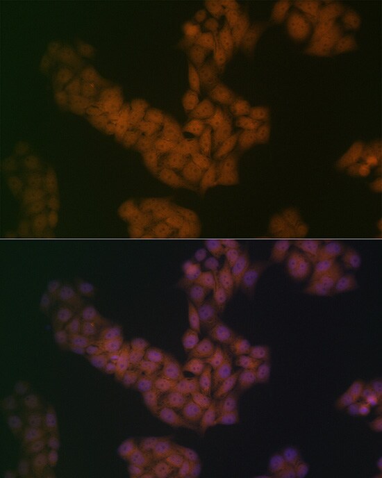 BANF1 Antibody (6J8O2)