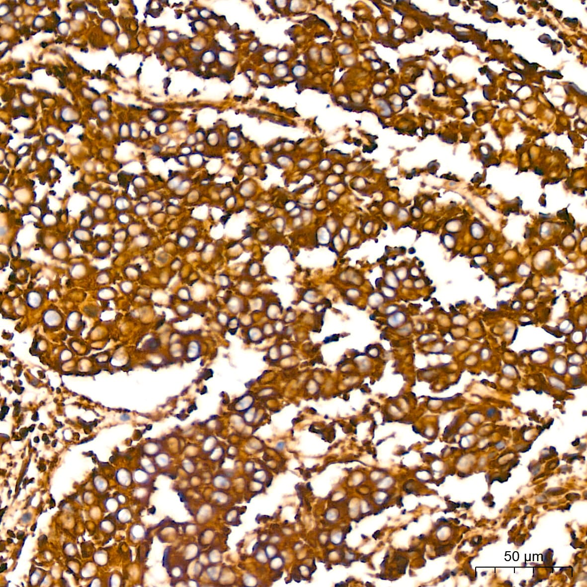 Filamin A Antibody (3X8Y9)