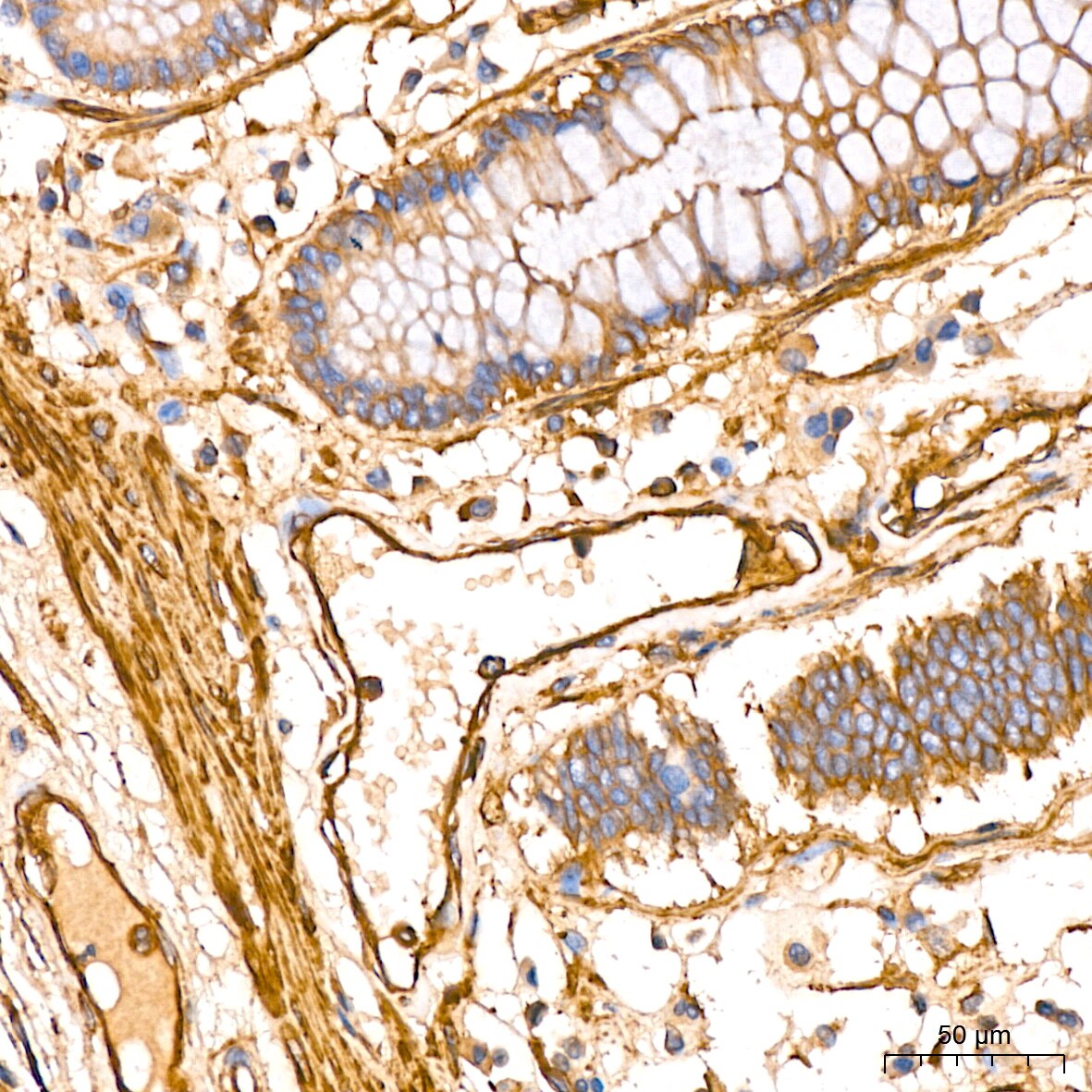Filamin A Antibody (3X8Y9)