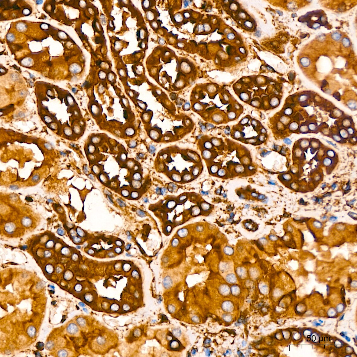 Filamin A Antibody (3X8Y9)