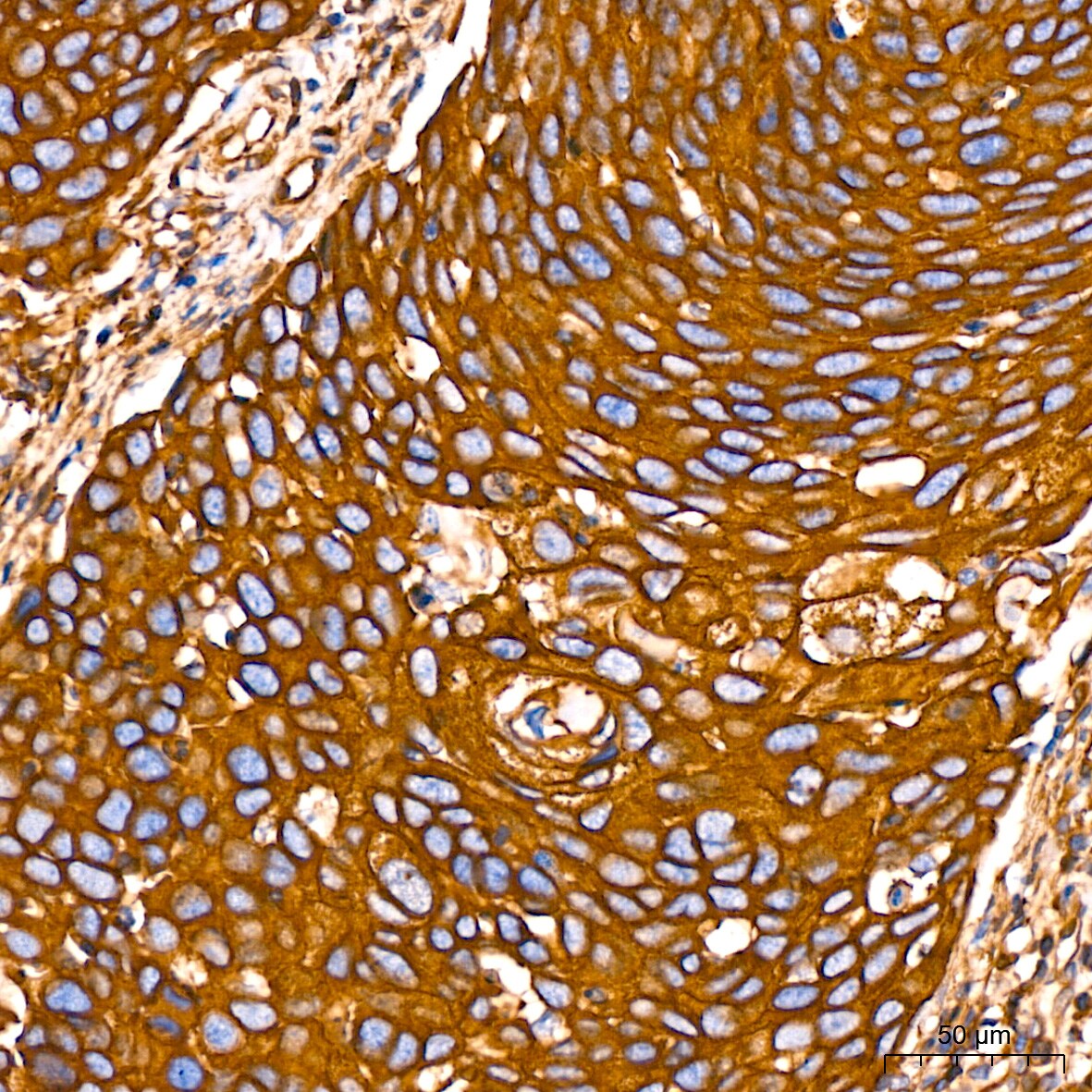 Filamin A Antibody (3X8Y9)