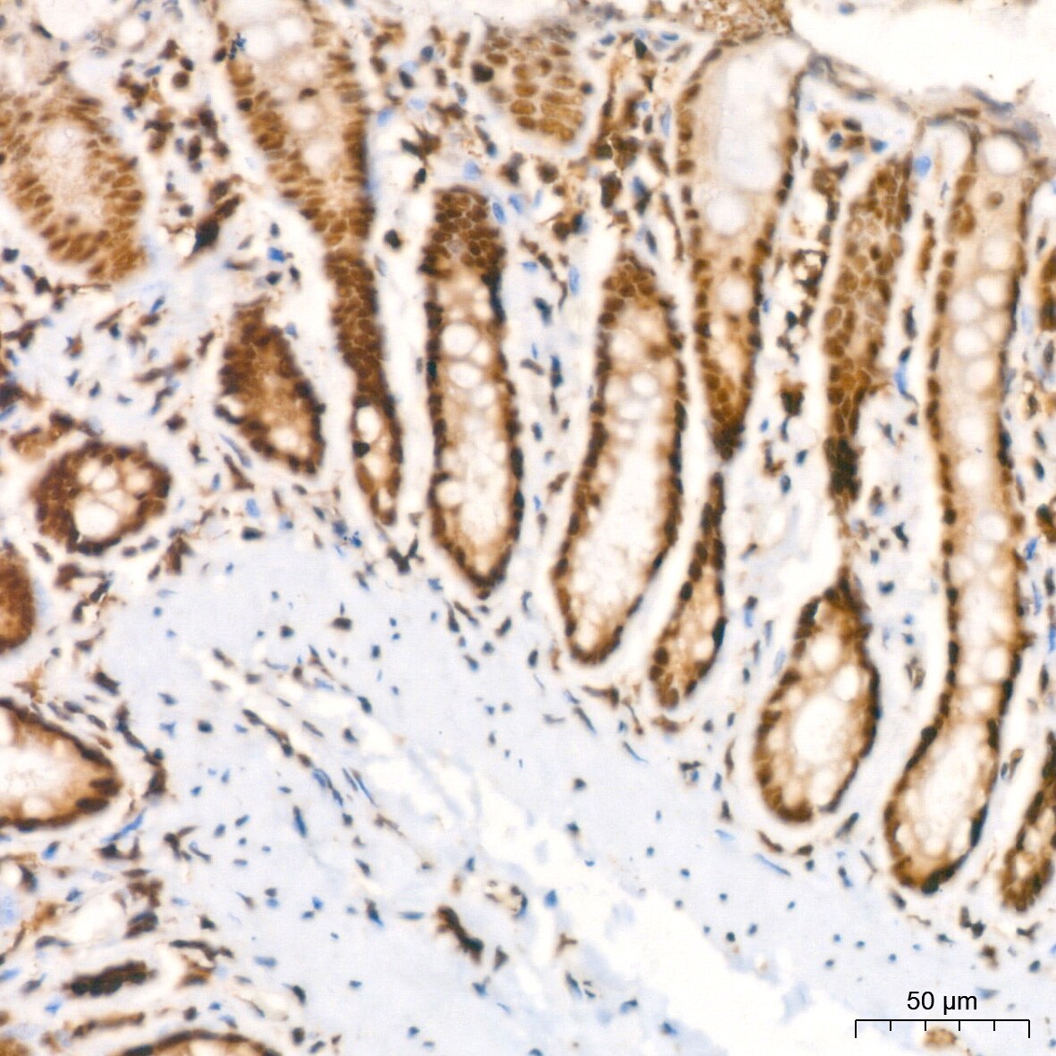 HP1 alpha Antibody (8C3M6)