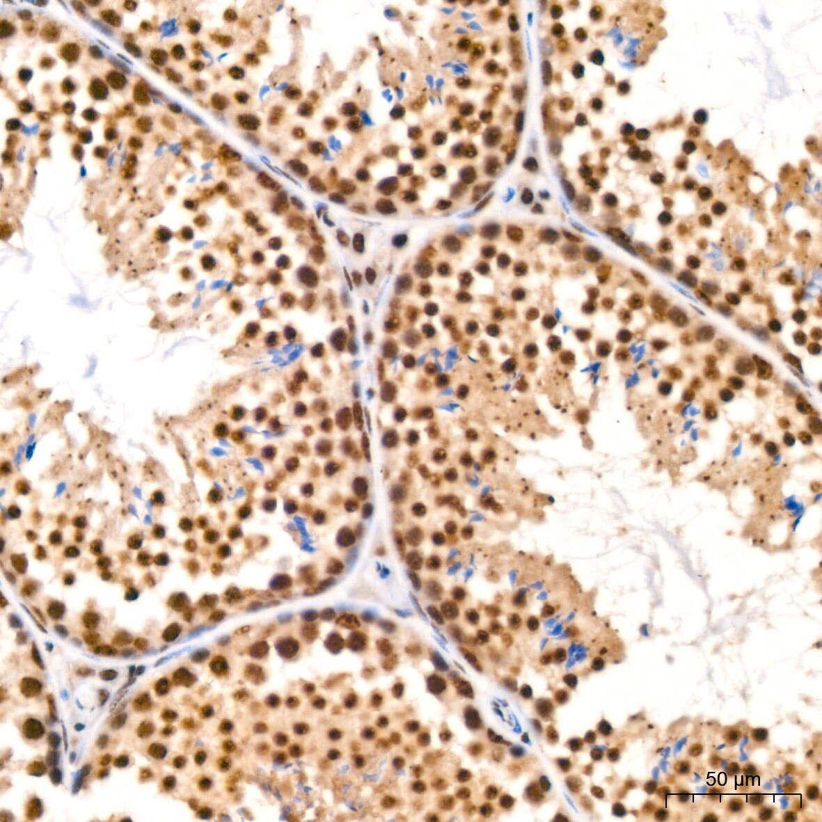 HP1 alpha Antibody (8C3M6)