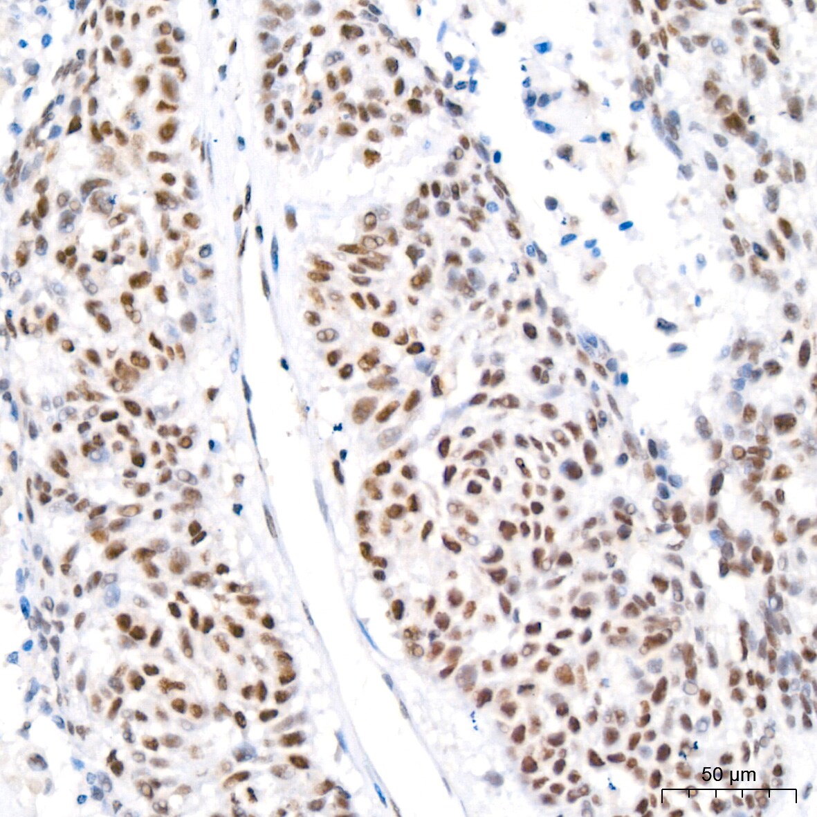 HP1 alpha Antibody (8C3M6)
