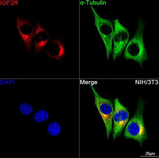 IGF-II R/IGF2R Antibody (4J4A3)