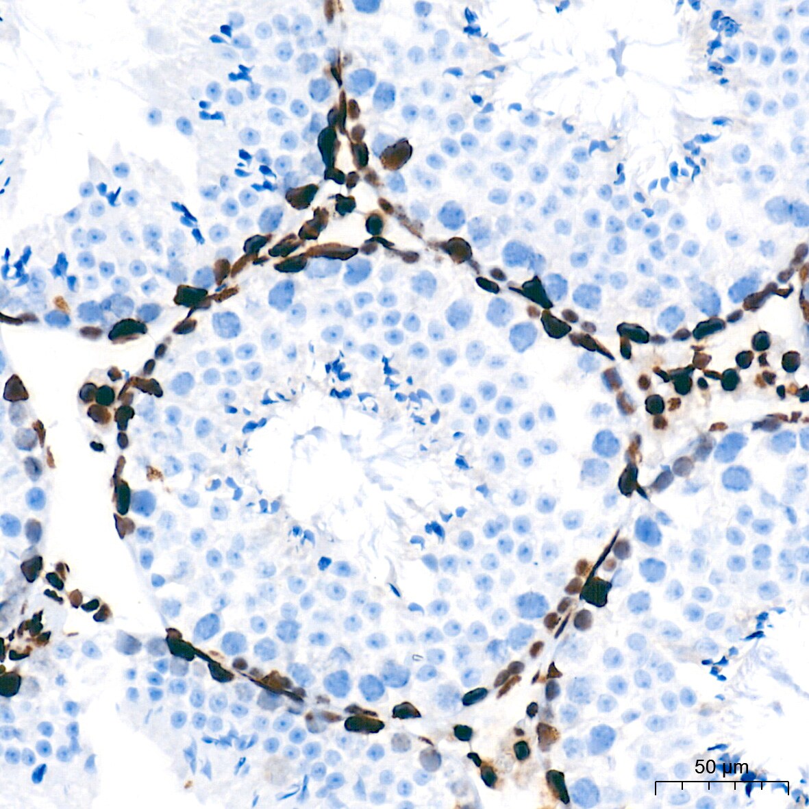 NONO Antibody (0V0N8)