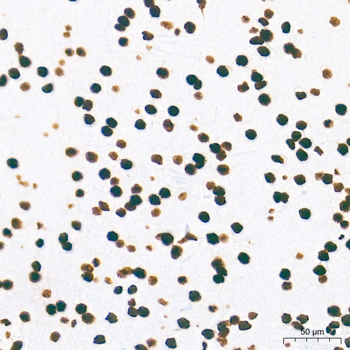NONO Antibody (0V0N8)