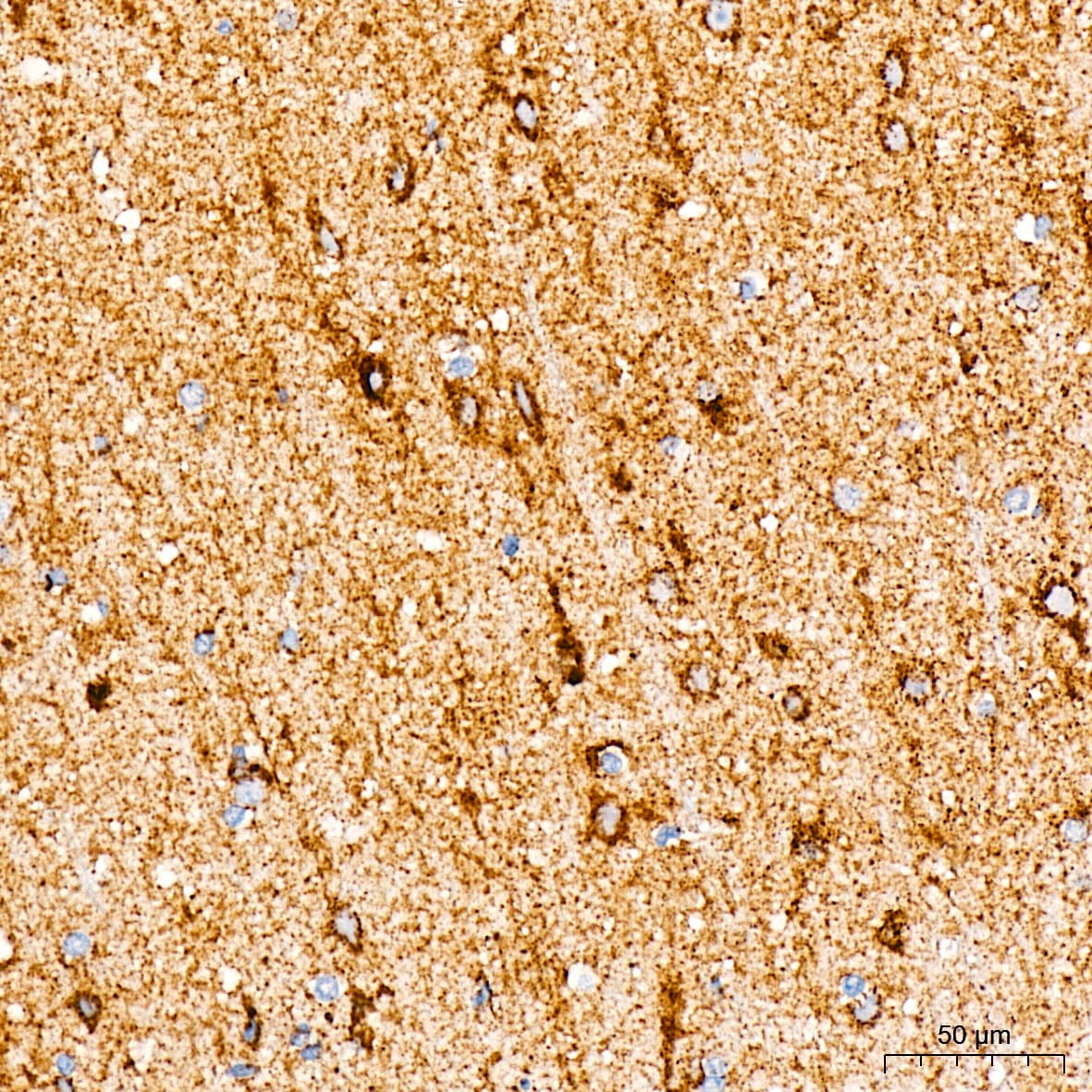 MT-CO2 Antibody (6H0N5)