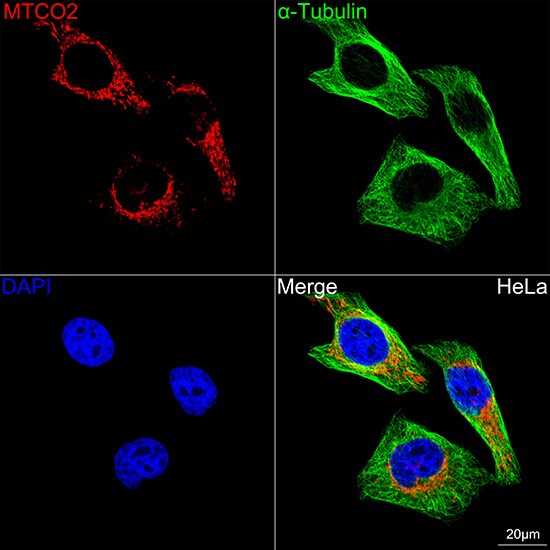 MT-CO2 Antibody (6H0N5)
